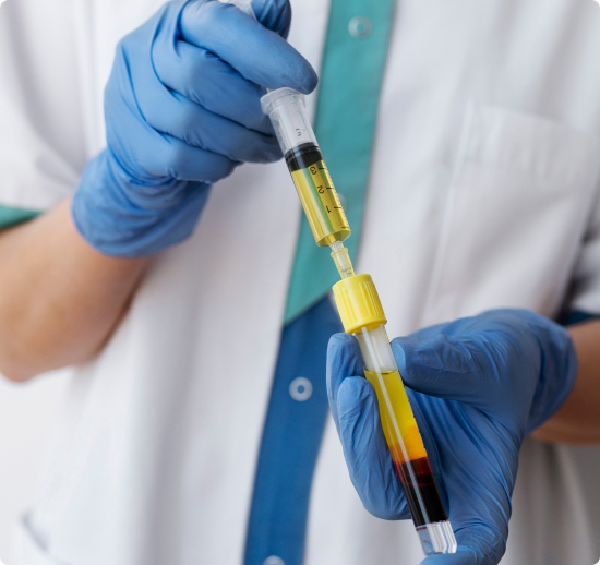 Platelet-Rich-Plasma
