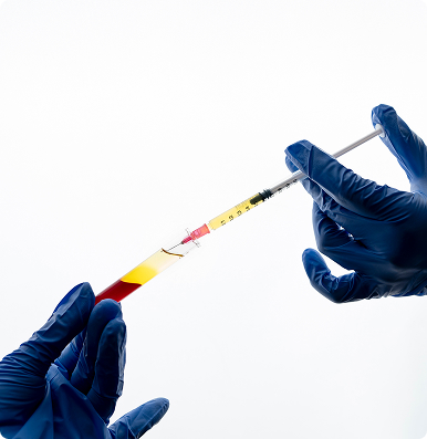 PRP Injection Image