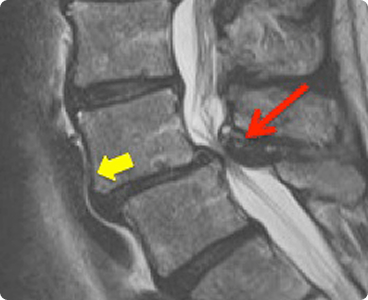 treatment-image